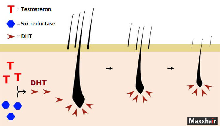 Kẽm và L-Arginin giúp cân bằng giữa DHT và testosterone