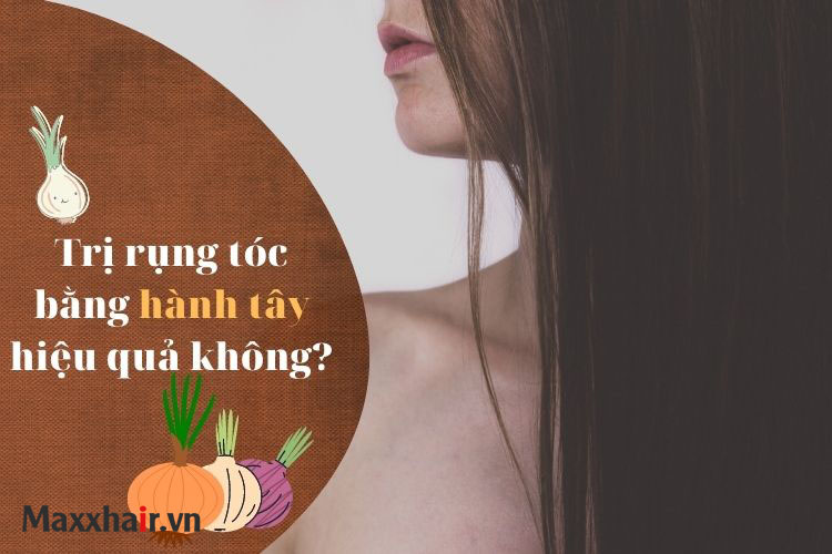 Hành tây có thể trị rụng tóc không? 1