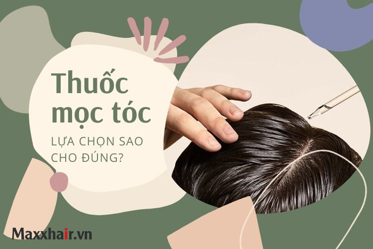 Thuốc mọc tóc tốt nhất là gì? Lựa chọn sao cho đúng?