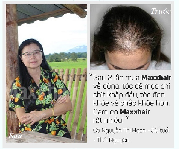 Quà tặng tới Quý khách: TẶNG ngay 1 hộp 30 viên trị giá 205.000đ khi mua 4 hộp Maxxhair 3