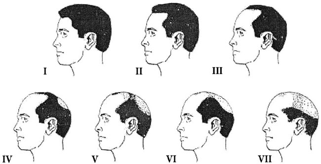 TRẢ LỜI 1