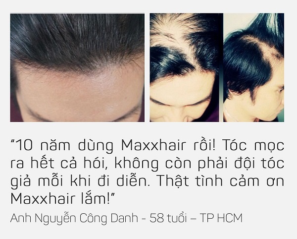 Review Maxxhair - phản hồi từ người dùng 3