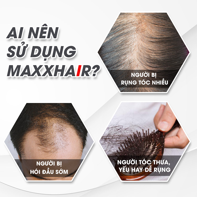 Đối tượng sử dụng Maxxhair 1