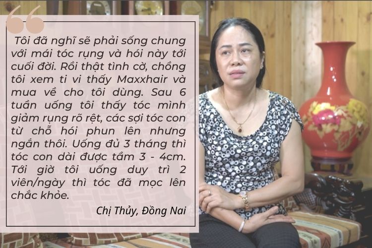 Viên uống Maxxhair - Giải pháp cải thiện hói đầu từ bên trong 3