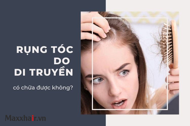 Rụng tóc do di truyền là gì? có chữa được không?