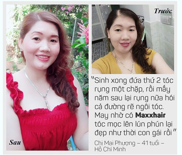 Maxxhair - Cải thiện tình trạng rụng tóc hiệu quả 3