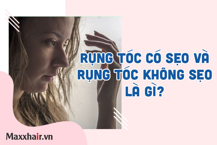 Rụng tóc có sẹo và rụng tóc không sẹo là gì? Nguyên nhân và cách điều trị. 1