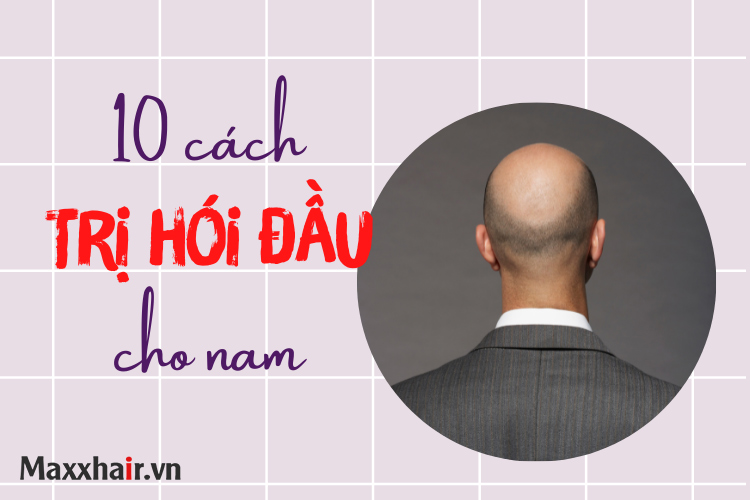 Top 10 cách trị hói đầu ở nam giới khoa học và hiệu quả