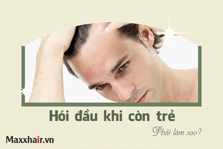 Bị hói đầu khi còn trẻ làm sao để cải thiện?