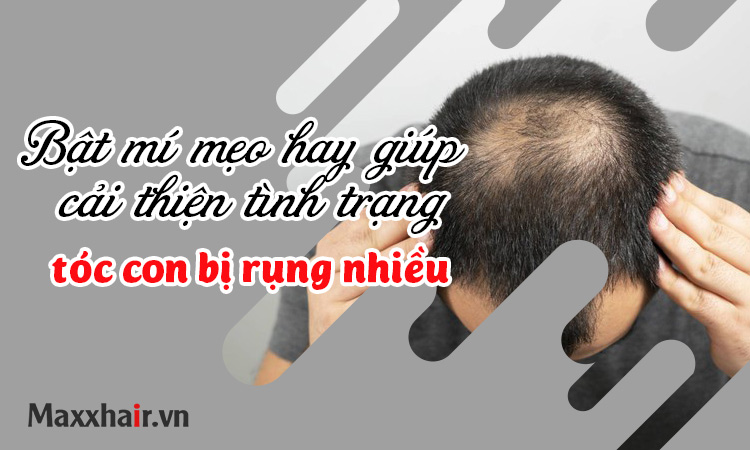 Bật mí mẹo hay giúp cải thiện tình trạng tóc con bị rụng nhiều