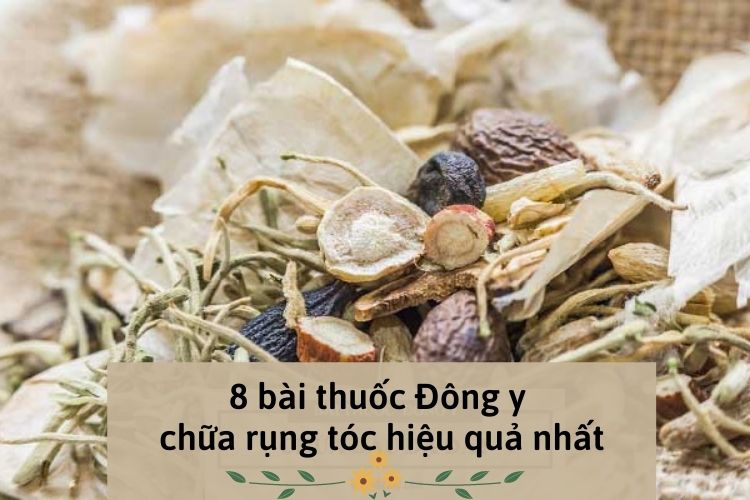 8 bài thuốc đông y chữa rụng tóc hiệu quả nhất