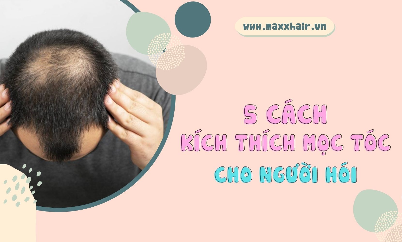 Mách bạn 5 cách kích thích mọc tóc đơn giản cho người hói