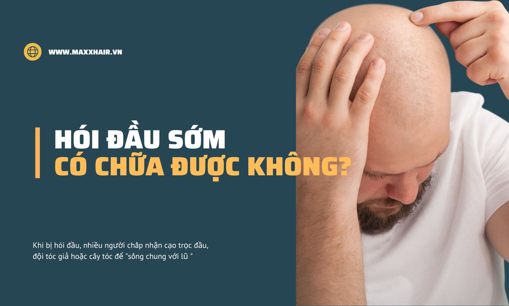 Hói đầu sớm có thể chữa được không?