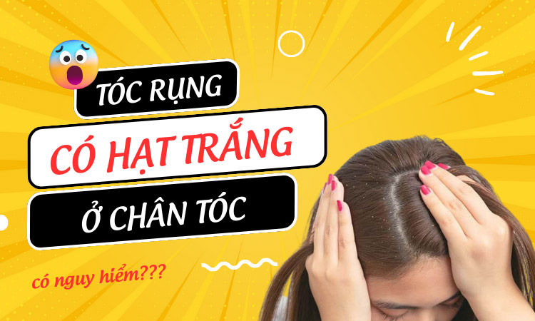 Tóc rụng nhiều chân tóc có hạt trắng?