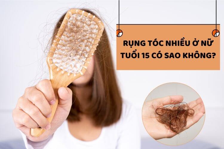 Rụng tóc nhiều ở nam, nữ trong độ tuổi 15 có thể là cảnh bảo của nhiều bệnh khác nhau