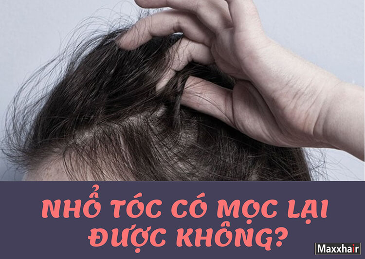 Nhổ tóc có mọc lại được không?