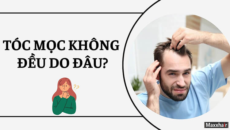 Tóc mọc không đều do đâu? Cách khắc phục hiệu quả