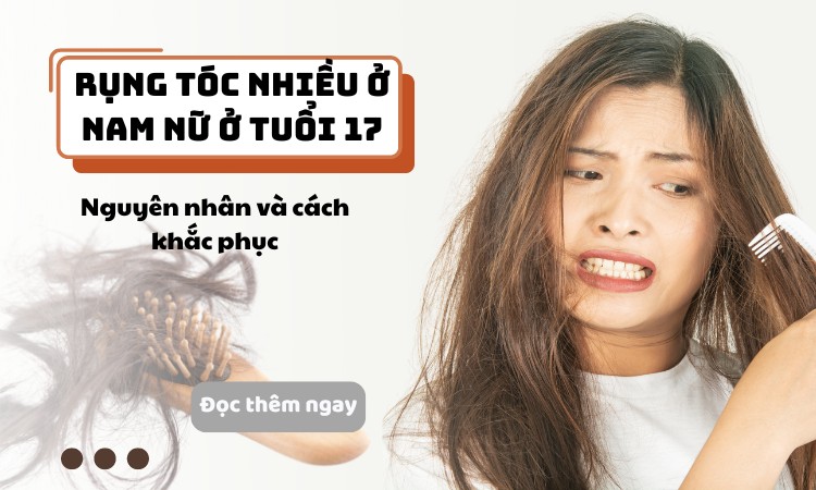 Nguy cơ gặp phải bệnh lý khi bị rụng tóc ở tuổi 17