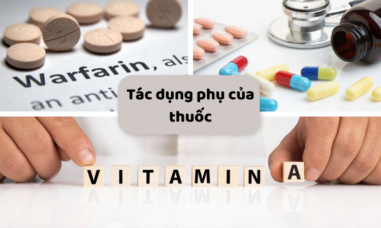 Tác dụng phụ của thuốc chống đông máu có thể gây rụng tóc